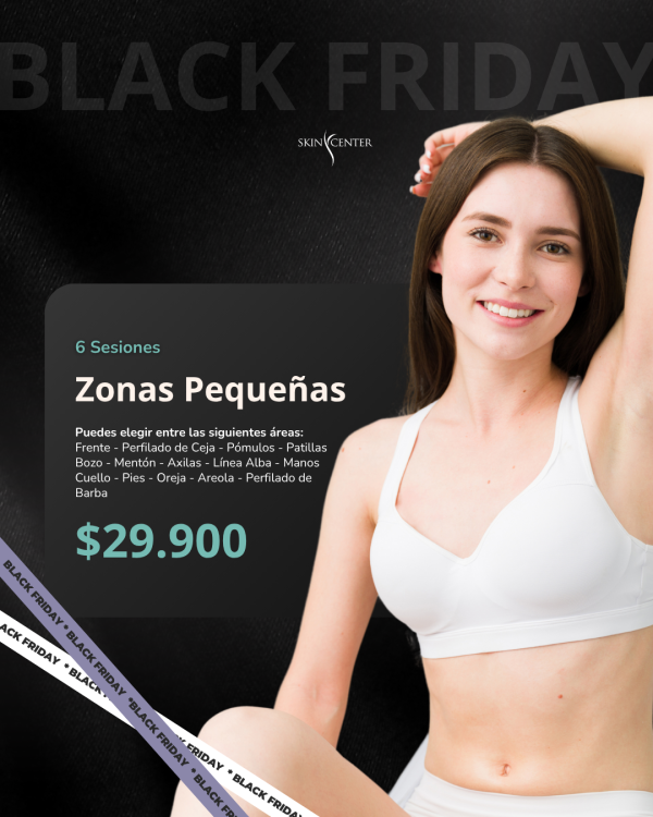 Depilación Láser - 6 Sesiones de Zonas Pequeñas