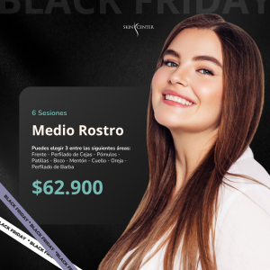 Depilación Láser - 6 Sesiones de Medio Rostro (3 zonas)