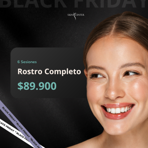 Depilación Láser - 6 Sesiones de Rostro Completo