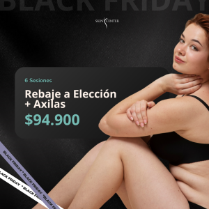 Depilación Láser - 6 Sesiones Rebaje a Elección + Axilas