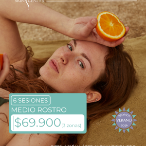 Depilación Láser - 6 Sesiones de Medio Rostro (3 zonas)