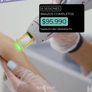 Depilación Láser - 6 Sesiones de Brazos Completos