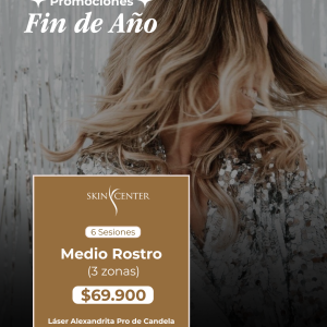 Depilación Láser - 6 Sesiones de Medio Rostro (3 zonas)