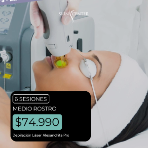Depilación Láser - 6 Sesiones de Medio Rostro (3 zonas)