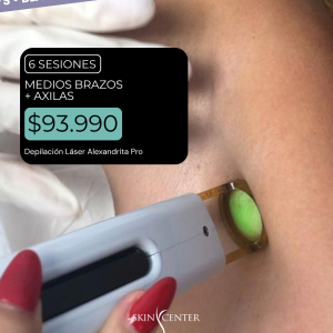 Depilación Láser - 6 Sesiones de Medios Brazos + Axilas