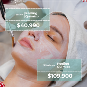 1 Sesión de Peeling Químico Hidratante