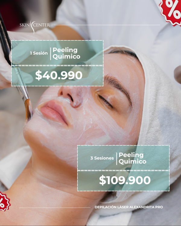1 Sesión de Peeling Químico Hidratante