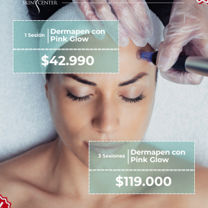 1 Sesión de Dermapen con Pink Glow