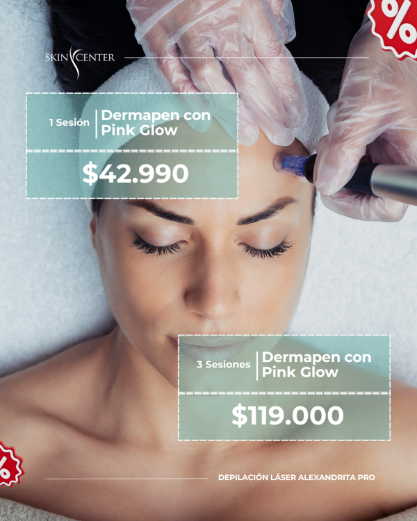 1 Sesión de Dermapen con Pink Glow
