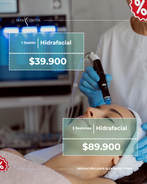1 Sesión de Hidrafacial