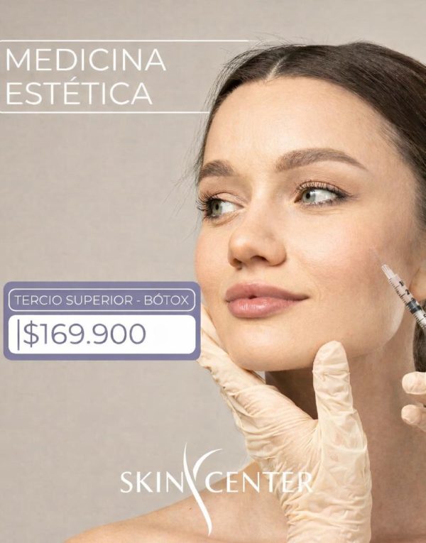 3 Zonas de Botox