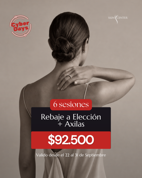 Depilación Láser - 6 Sesiones Rebaje a Elección + Axilas