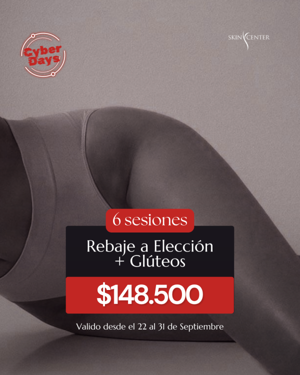 Depilación Láser - 6 Sesiones Rebaje a Elección + Glúteos