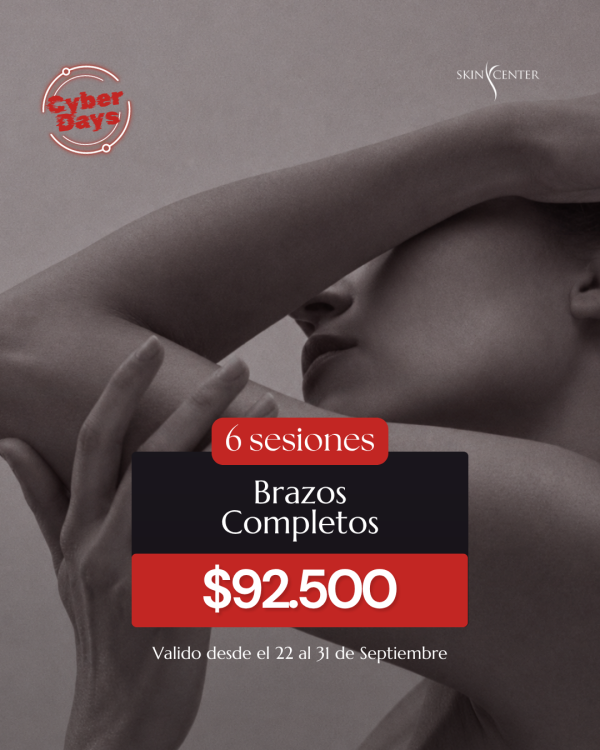 Depilación Láser - 6 Sesiones de Brazos Completos