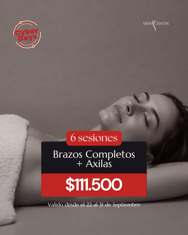Depilación Láser - 6 Sesiones de Brazos Completos + Axilas