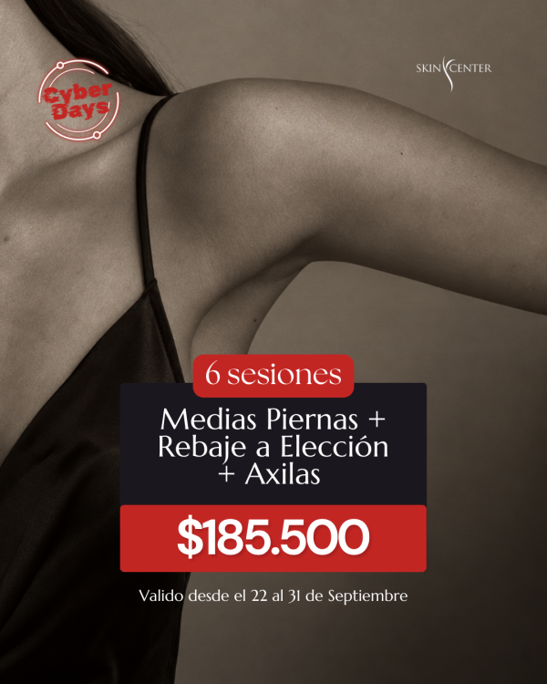 Depilación Láser - 6 Sesiones de Medias Piernas + Rebaje a Elección + Axilas