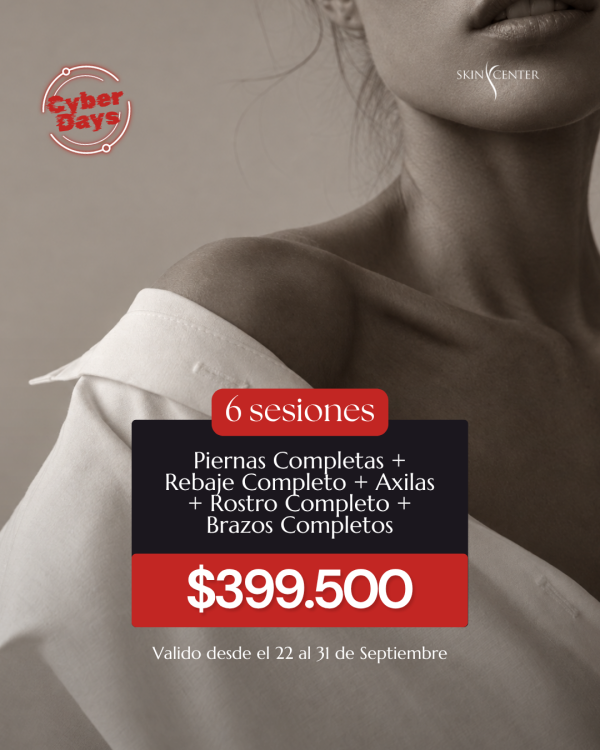 Depilación Láser - 6 Sesiones de Piernas Completas + Rebaje Completo + Axilas + Rostro Completo + Brazos Completos