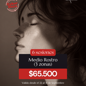 Depilación Láser - 6 Sesiones de Medio Rostro (3 zonas)
