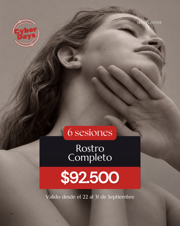Depilación Láser - 6 Sesiones de Rostro Completo